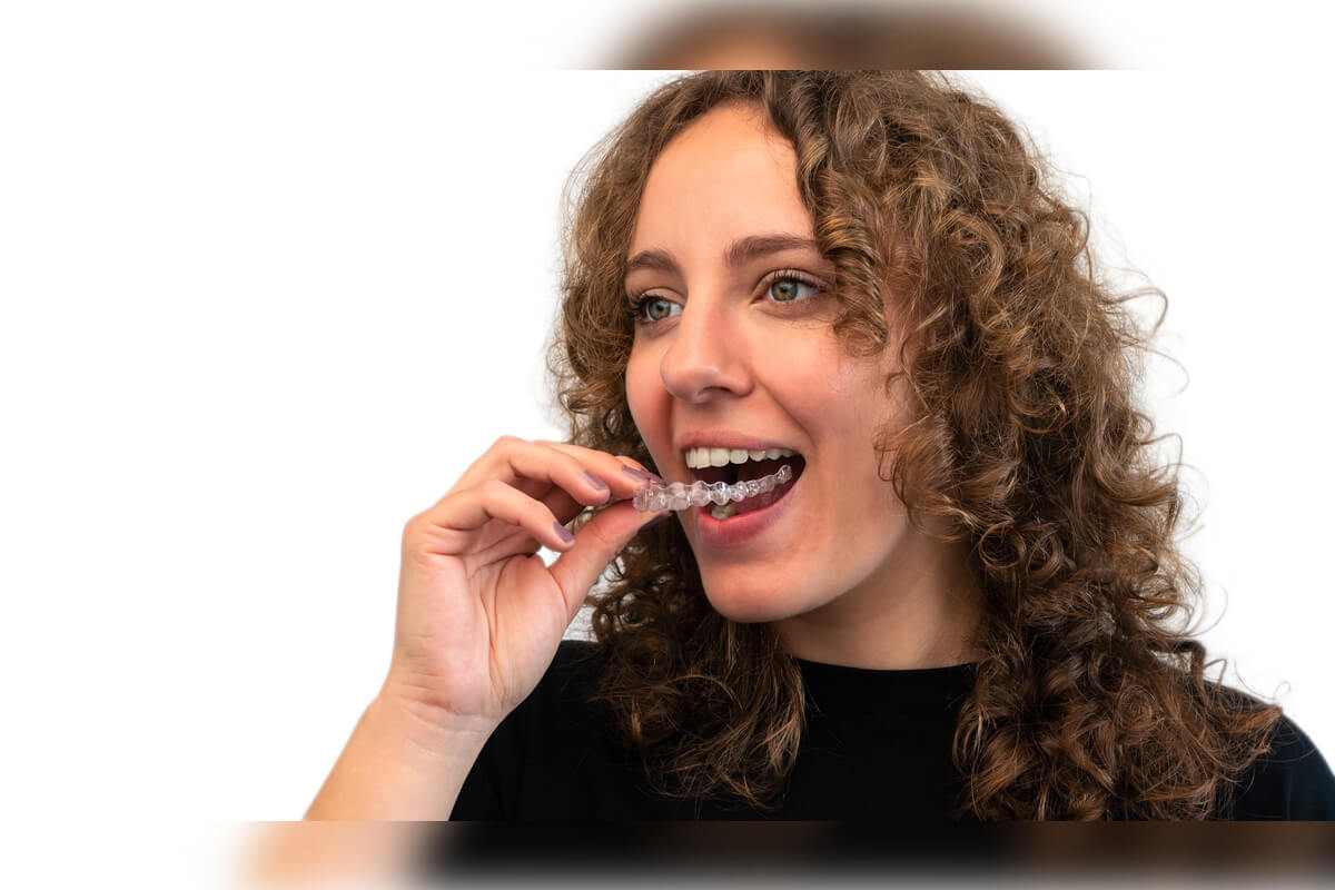 Clear Aligners vs. Traditional Braces - A young woman with curly hair is seen placing a clear aligner onto her teeth. The aligner is transparent and designed to fit snugly over her teeth, offering a nearly invisible solution for orthodontic treatment. The woman’s expression is positive, reflecting the comfort and convenience of using clear aligners compared to traditional braces. The image emphasizes the user-friendly aspect of clear aligners, which can be easily removed and reinserted, highlighting their appeal over more noticeable and permanent metal braces.