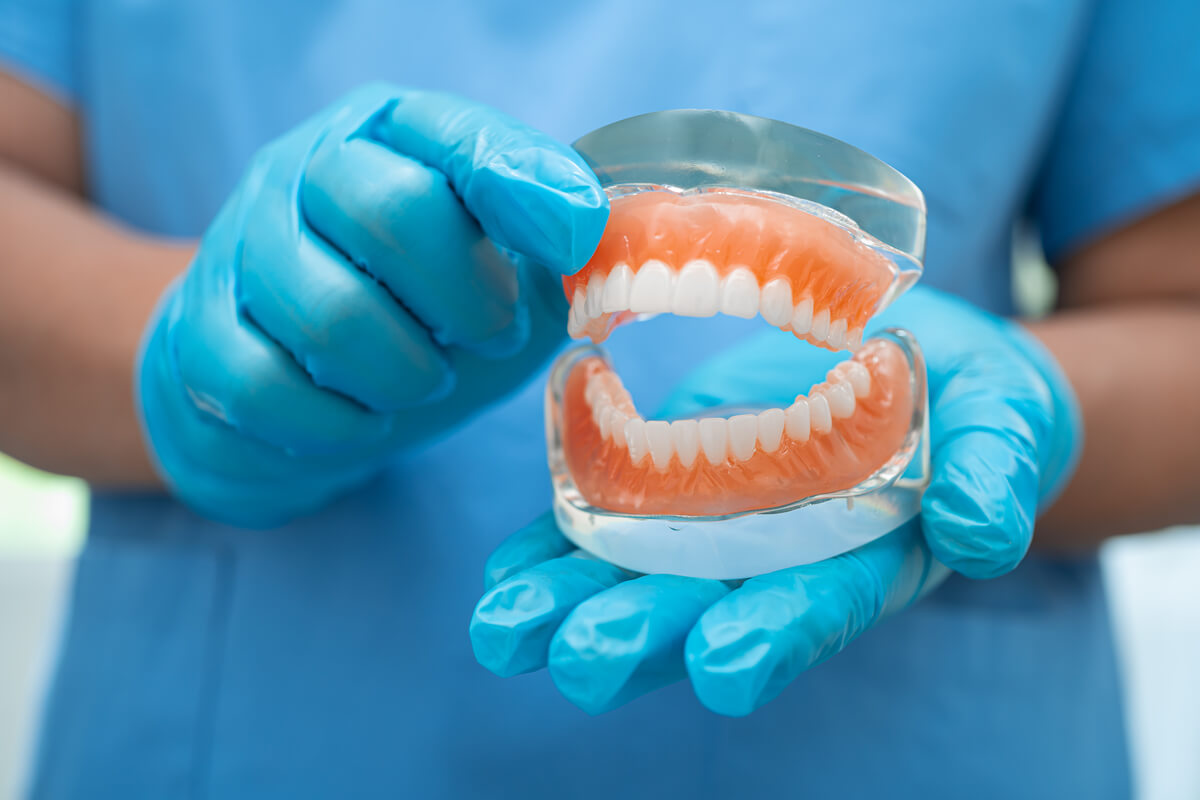 Custom Full Dentures - A dental professional wearing blue gloves is holding a model of custom full dentures, showcasing both the upper and lower sets of artificial teeth. The detailed model emphasizes the precision and care involved in crafting these dentures to fit a patient’s mouth perfectly. The setting suggests a clinical environment, likely a dental office, where custom full dentures are designed to restore full dental function and aesthetics for patients who have lost all of their natural teeth. The professional’s careful handling of the model underscores the importance of accuracy in creating dentures that ensure a comfortable fit and natural appearance.