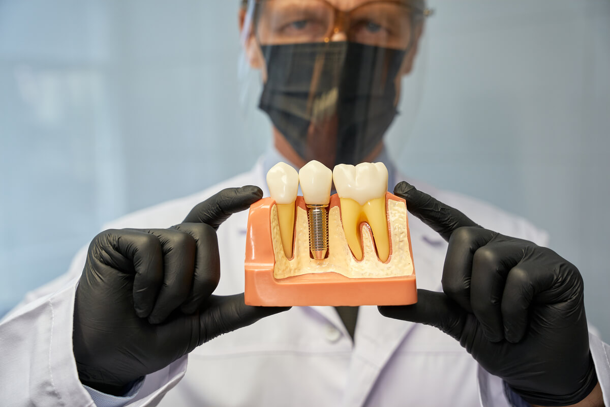 Dental Implants - A dental professional, wearing protective gear and black gloves, is showcasing a cross-sectional model of a human jaw. The model clearly illustrates the anatomy of a dental implant, featuring a titanium screw embedded in the jawbone, with a natural-looking crown attached on top. This detailed model emphasizes the stability and integration of dental implants, highlighting their role in replacing missing teeth. The setting suggests an educational environment, likely used to explain implant procedures, their benefits for jawbone health, and their role in supporting a confident, functional smile.