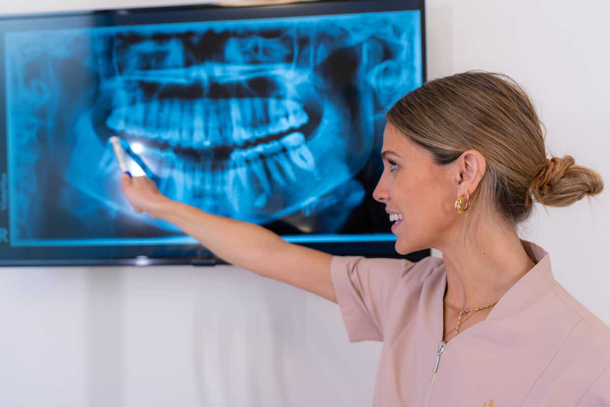 Low-Radiation Dental X-Rays - A dental professional is pointing to a detailed panoramic dental X-ray displayed on a screen. The X-ray image, taken using low-radiation technology, clearly shows the full set of the patient’s teeth, jawbone, and surrounding structures. The dental professional, dressed in a light pink uniform and wearing gold earrings, is explaining the findings to a patient, demonstrating the use of advanced imaging techniques in modern dentistry. The setting is a well-lit dental office, emphasizing the importance of safe diagnostic practices in providing high-quality dental care.